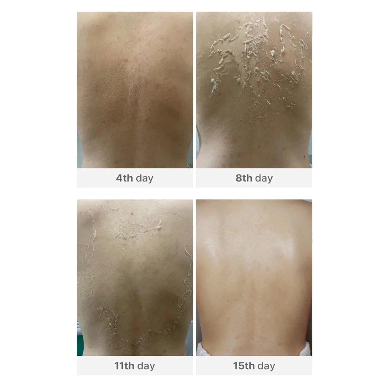 Medisco Peelieve Peeling - 5x1g+5x8ml