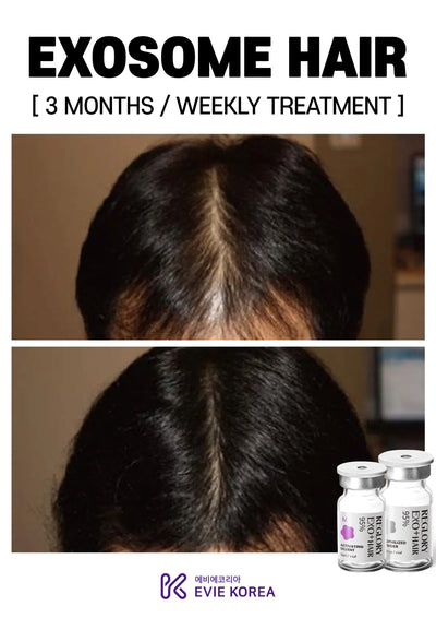 Reglory Exo+ Hair (Exosome) - 1x200mg+1x6ml