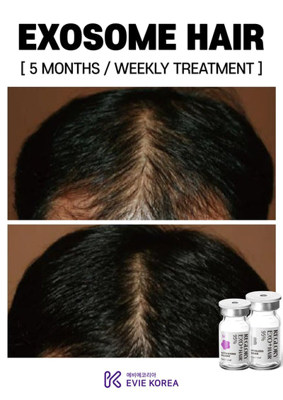 Reglory Exo+ Hair (Exosome) - 1x200mg+1x6ml