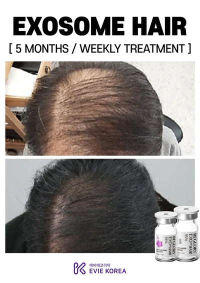 Reglory Exo+ Hair (Exosome) - 1x200mg+1x6ml