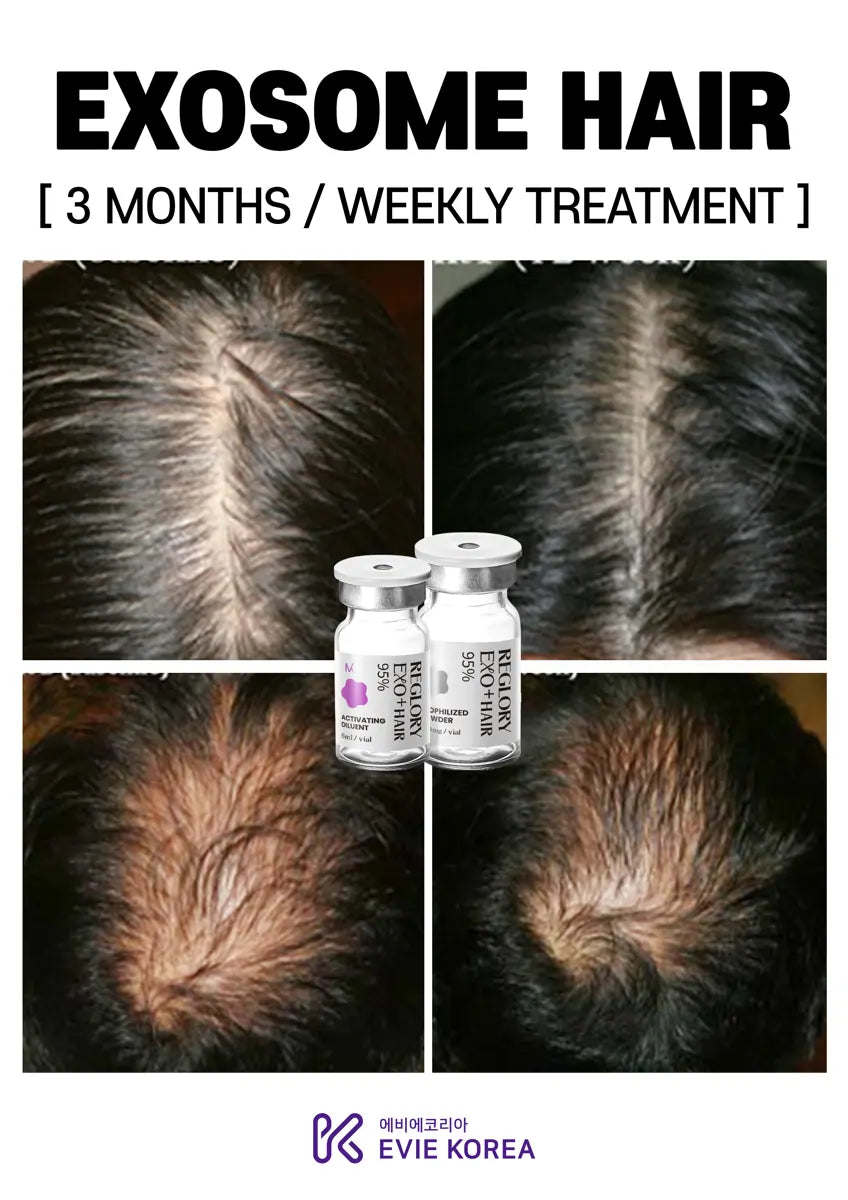 Reglory Exo+ Hair (Exosome) - 1x200mg+1x6ml