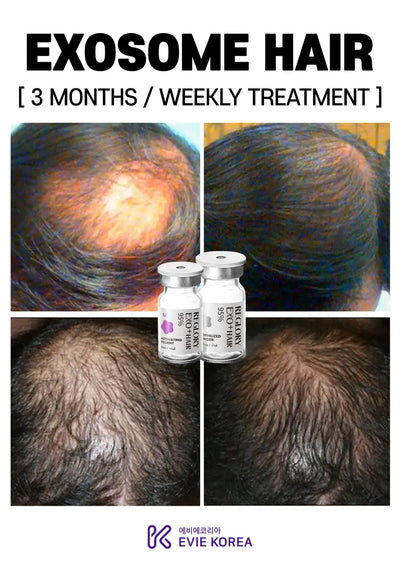 Reglory Exo+ Hair (Exosome) - 1x200mg+1x6ml