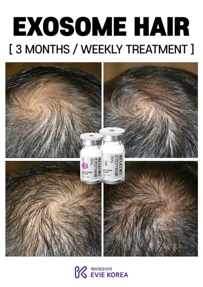 Reglory Exo+ Hair (Exosome) - 1x200mg+1x6ml